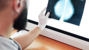Análisis de una mamografía en un hospital.