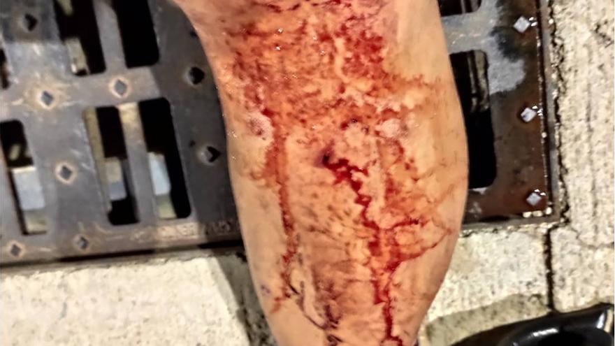 Las heridas que sufrió un agente en una pierna