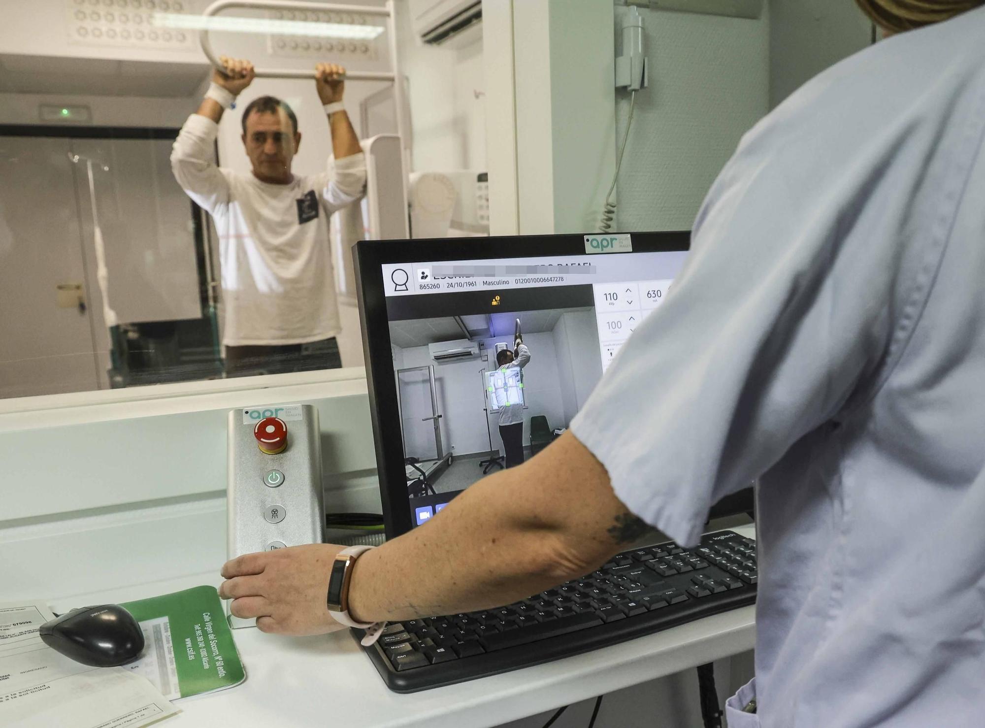 Alicante es el primer punto de España que hace radiografías con una cánara de inteligencia artificial