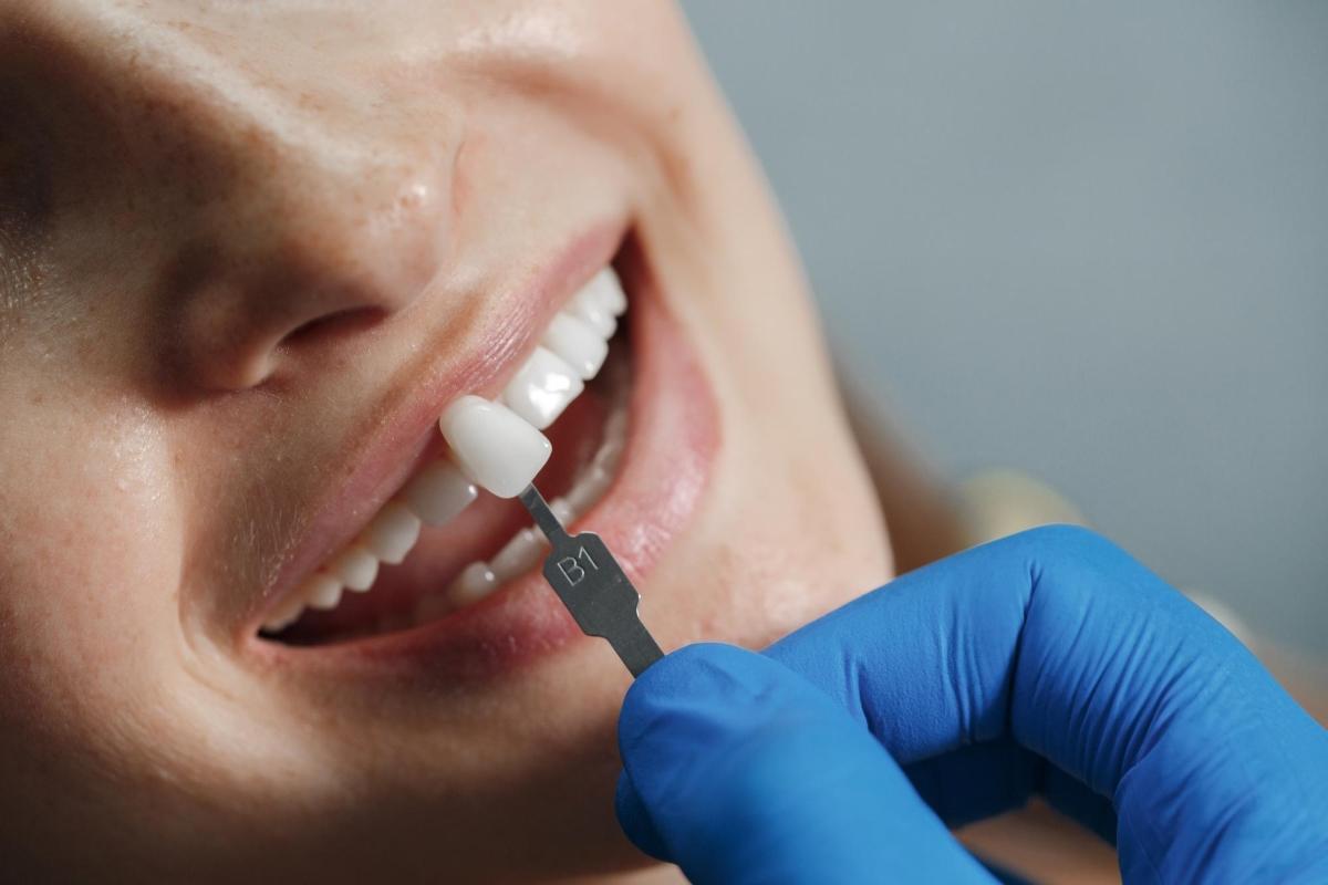 ¿La implantología sirve para salvar los dientes?