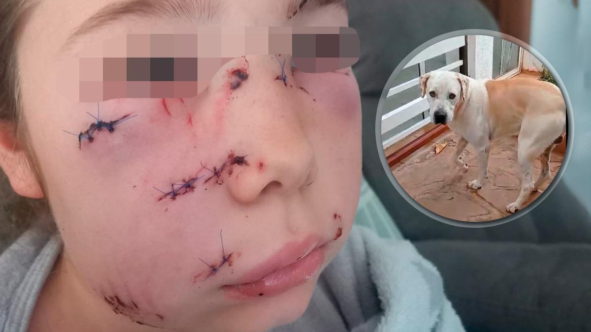 Imagen de la niña en las que se aprecian las importantes heridas en la cara de la niña. En la foto pequeña, el perro.