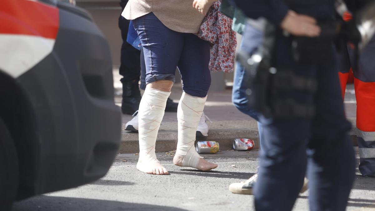 Una de las personas heridas por una carcasa en la mascletà de hoy.