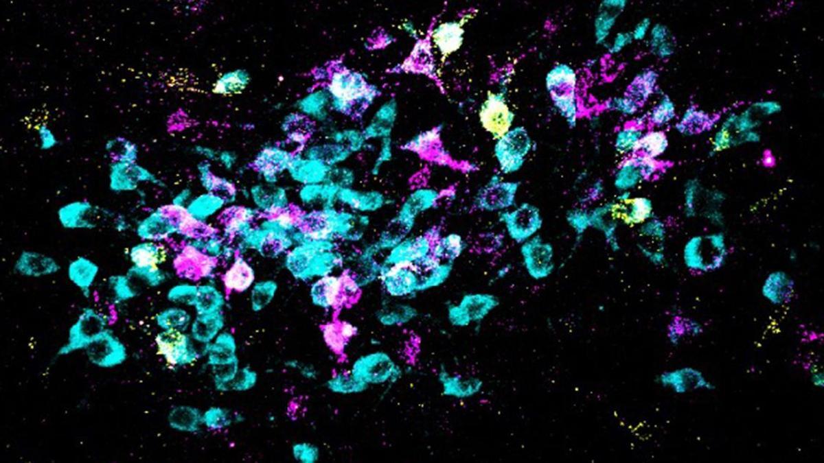 Una nueva investigación identifica la bioquímica del cerebro y los circuitos neuronales que causan experiencias de miedo generalizadas. Aquí, las neuronas se muestran en cian y los trazadores retrógrados en amarillo y magenta.