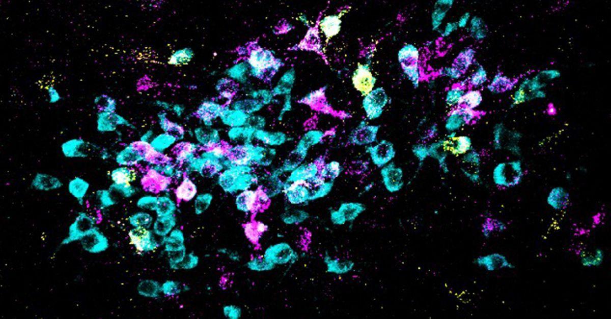 Una nueva investigación identifica la bioquímica del cerebro y los circuitos neuronales que causan experiencias de miedo generalizadas. Aquí, las neuronas se muestran en cian y los trazadores retrógrados en amarillo y magenta.