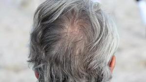 Una persona con canas.