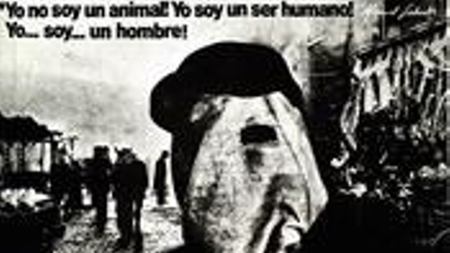 El hombre elefante