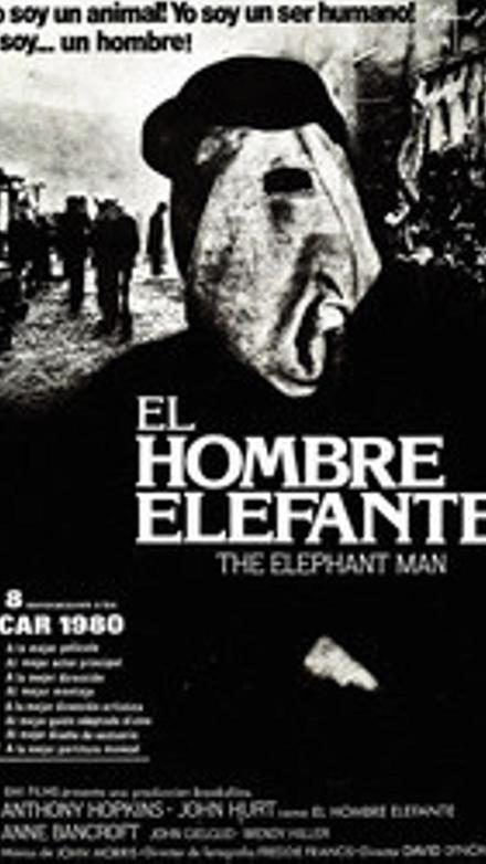 El hombre elefante