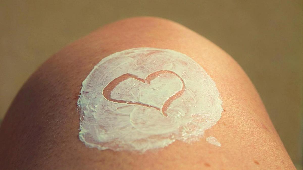 El lentigo solar es la lesión de la piel más frecuente.