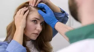Los suplementos de Biotina más buscados para frenar la caída del cabello