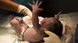 Reducir "al mínimo" las cesáreas y fomentar el parto natural: el Macarena impulsa un protocolo para las madres