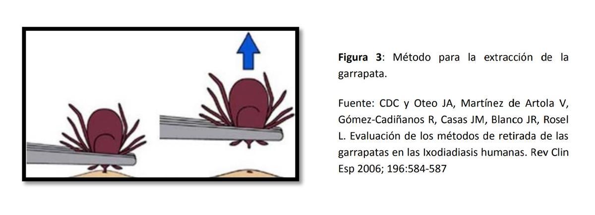 Cómo extraer una garrapata.