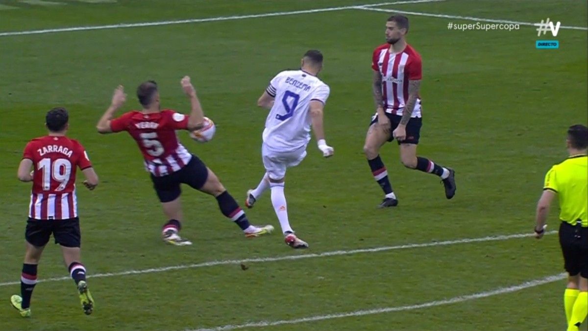 La mano de Yeray sancionada como penalti