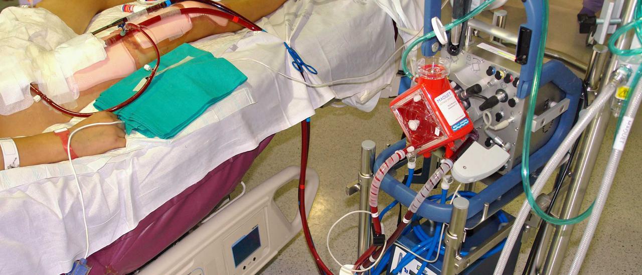 Un paciente conectado a una de las máquinas ECMO para oxigenarse su sangre sin comprometer los órganos.