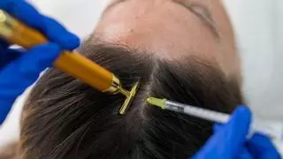 Descubre las soluciones efectivas para combatir la caída del pelo