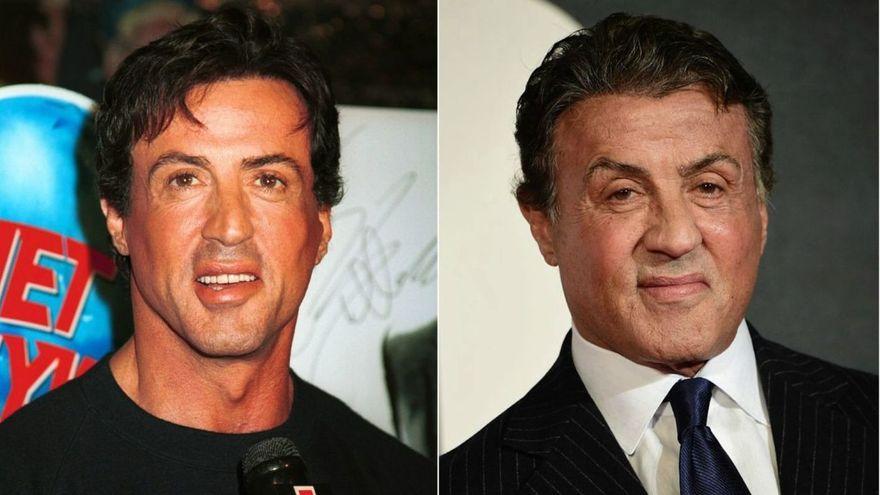 Sylvester Stallone.