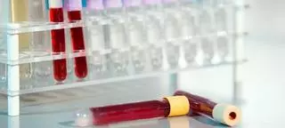 Si tienes estos tipos de sangre te afecta más la contaminación