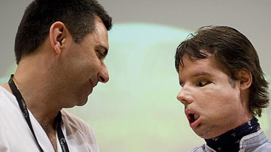 Oscar, el primer trasplantado de cara completa, da las gracias en público a sus médicos