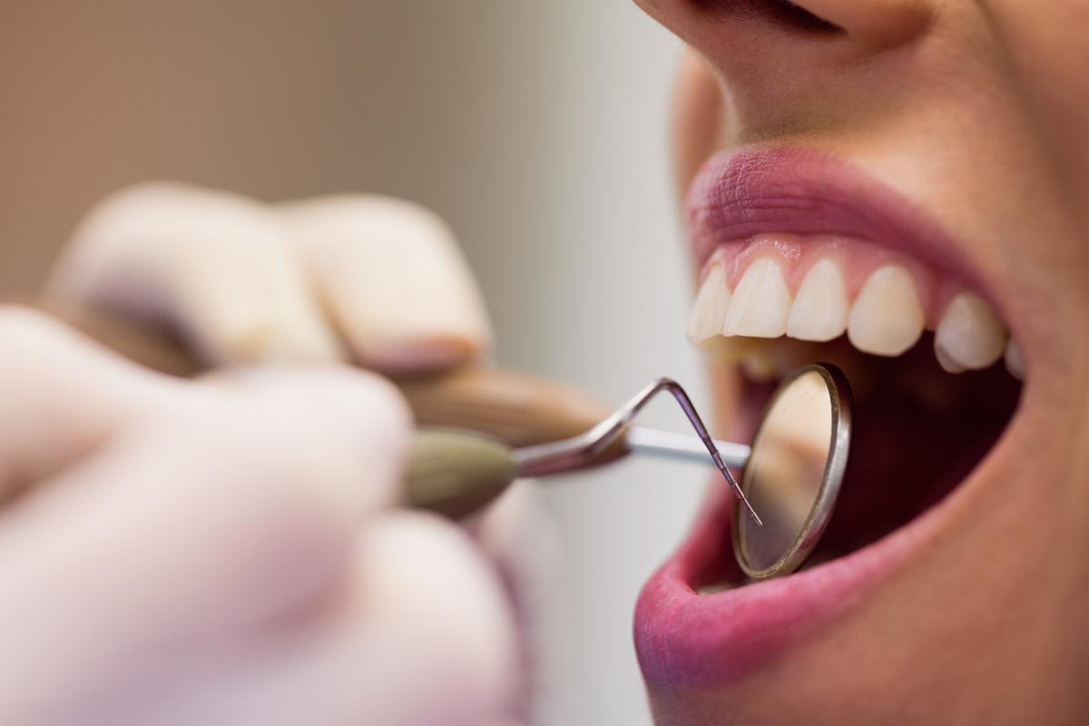 La odontofobia es el miedo extremo a ir al dentista