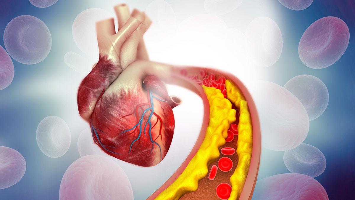 El aceite de orégano podría ayudar a reducir el colesterol LDL (malo) y aumentar los niveles de colesterol HDL (bueno).