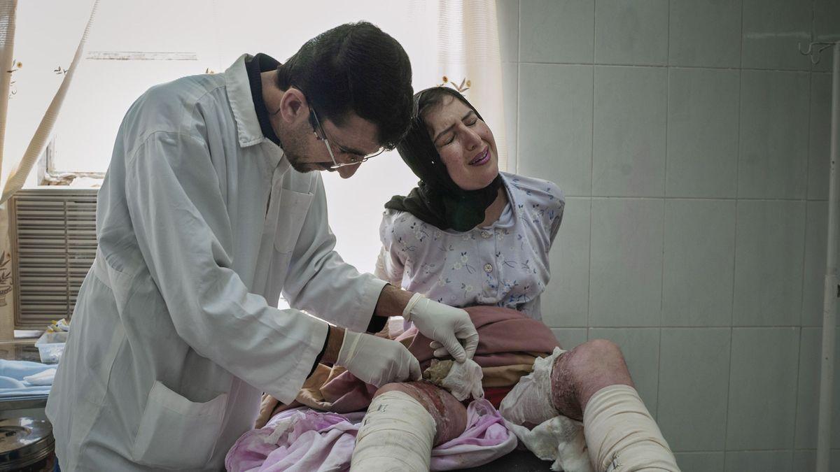 Una joven de 15 años, atendida en un hospital de la región autónoma del Kurdistán de Irak, en 2006.