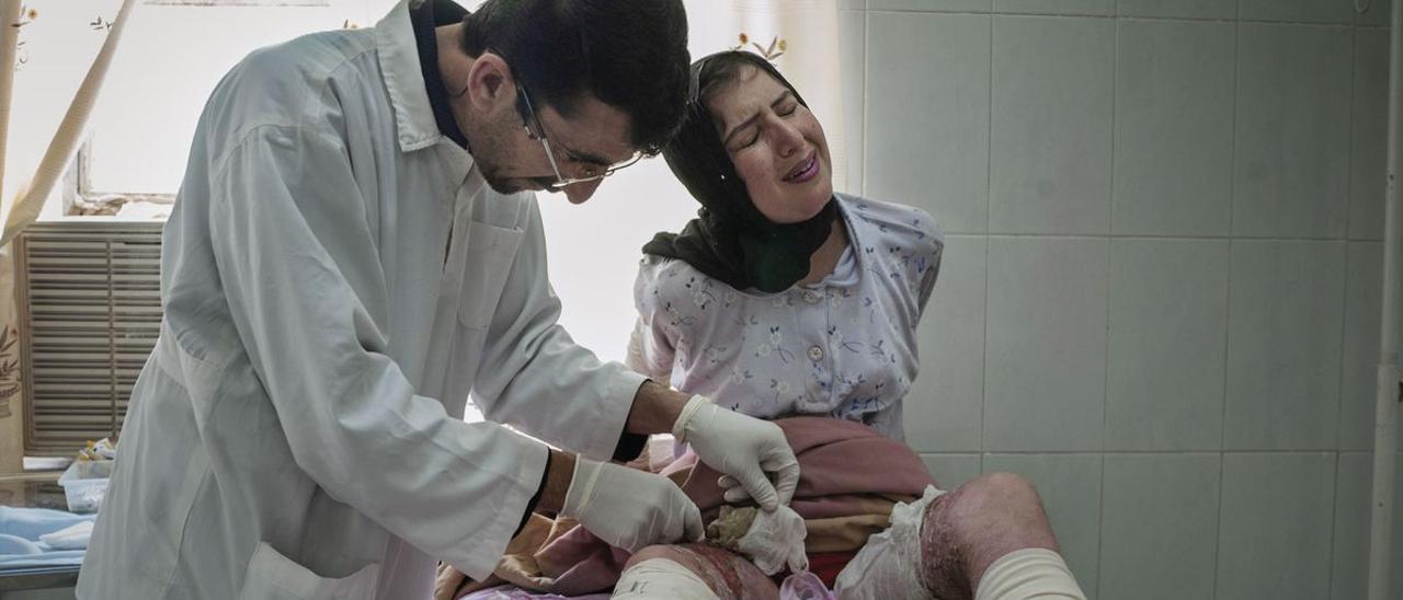 Una joven de 15 años, atendida en un hospital de la región autónoma del Kurdistán de Irak, en 2006.