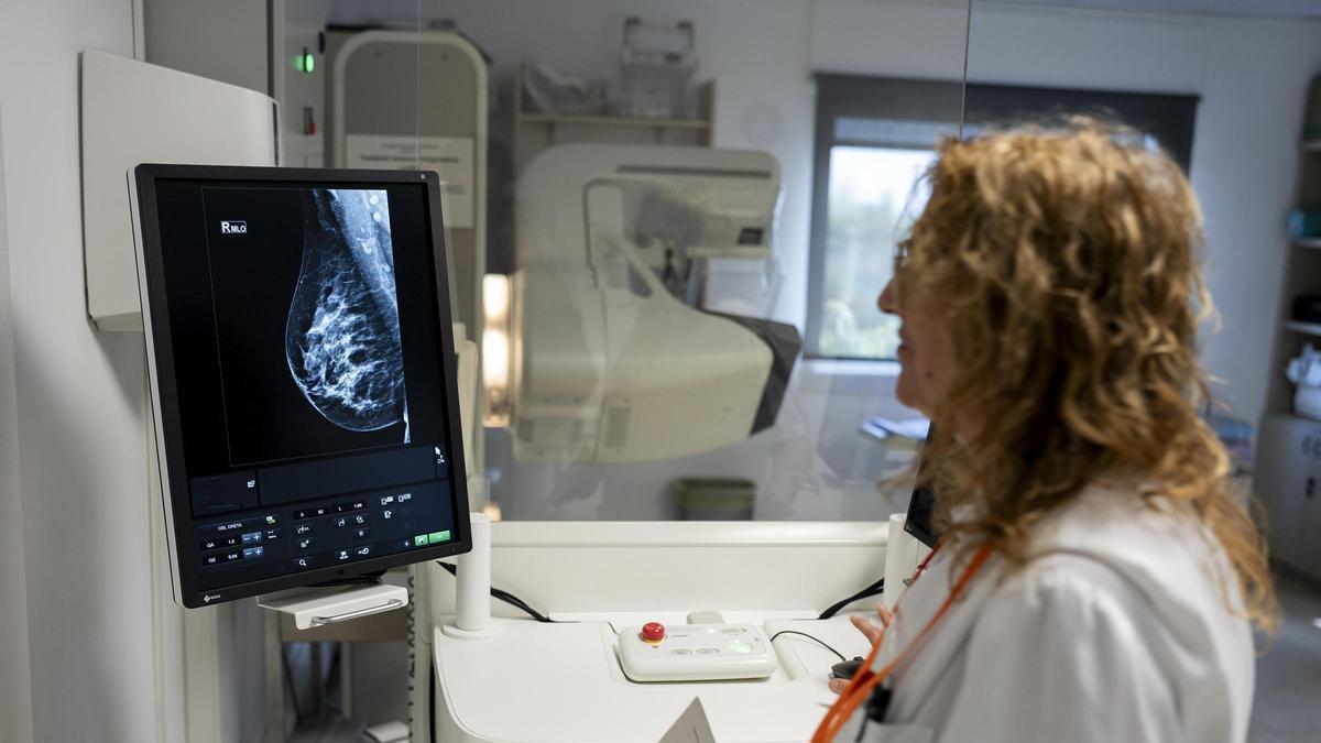 Una especialista en radiodiagnóstico realiza una mamografía a una mujer.
