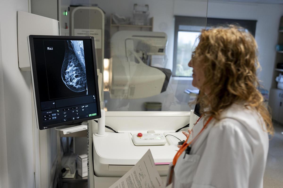 Una especialista en radiodiagnóstico realiza una mamografía a una mujer.