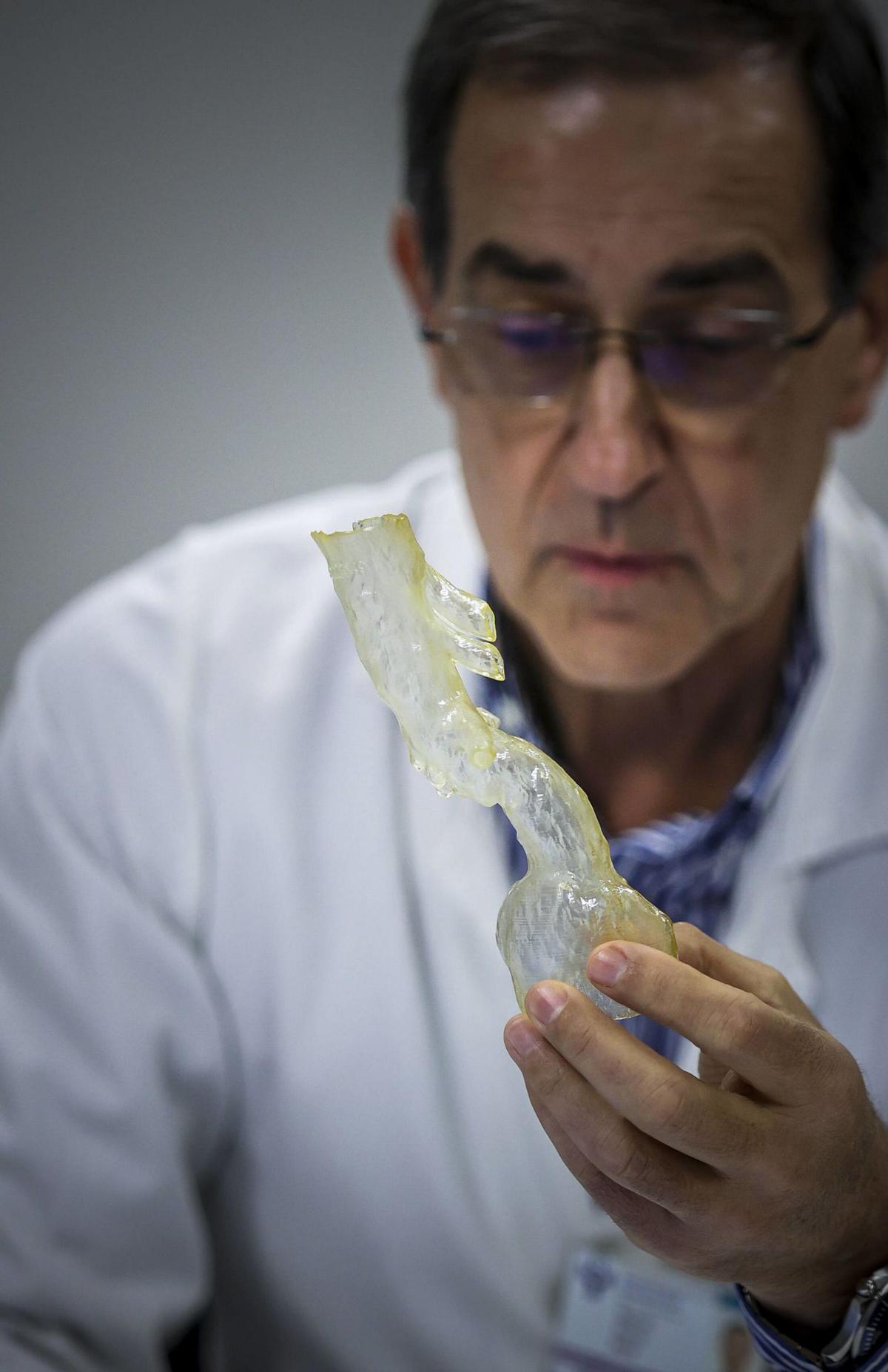 Doce horas en el quirófano para salvar la arteria más vital