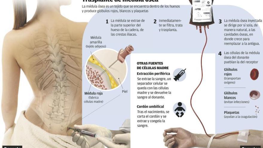 Trasplante de médula: reparar la fábrica de sangre