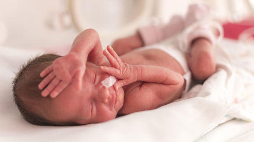 Un bebé prematuro ingresado en una unidad neonatal.
