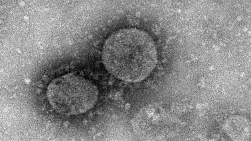 Una imagen del coronavirus.