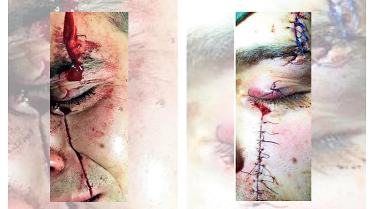 Imágenes del estado en el que quedó la víctima tras rajarle la cara el acusado.