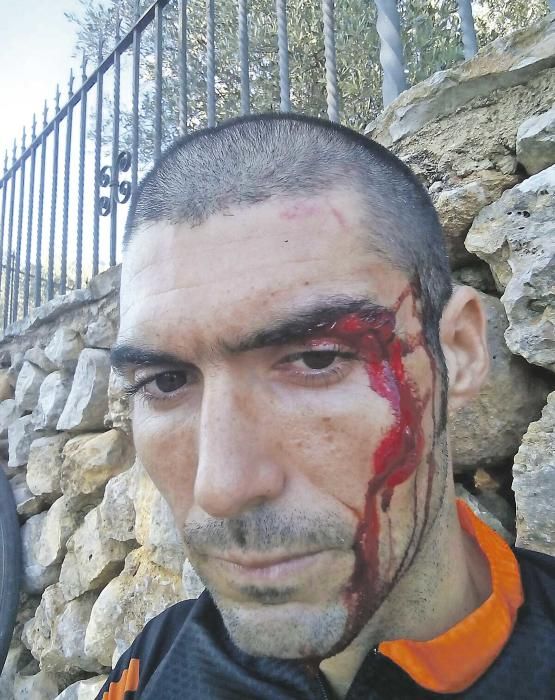 El triatleta Carlos López sufre un atropello en Binissalem