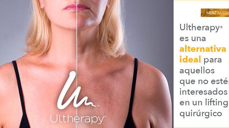 Ultherapy, el lifting no quirúrgico de la piel