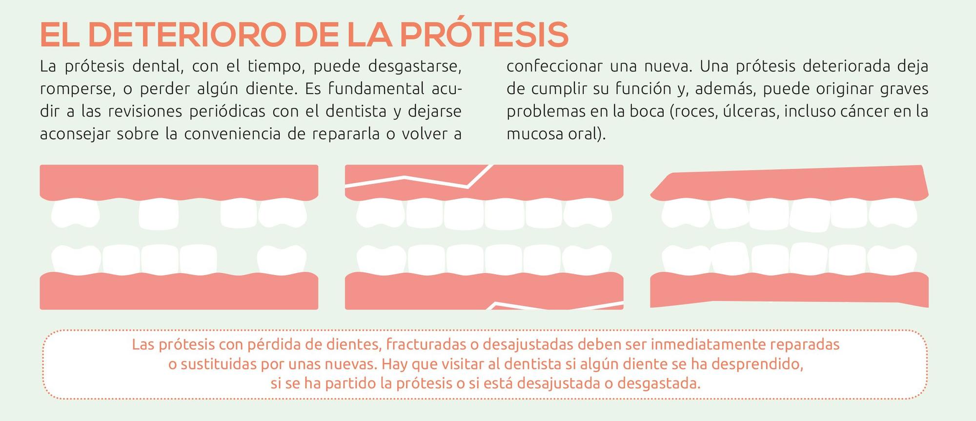 El deterioro de la prótesis.