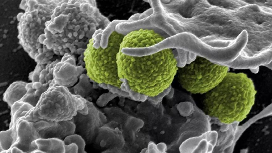 Staphylococcus aureus: així és el bacteri resistent que tanta guerra pot donar als peus