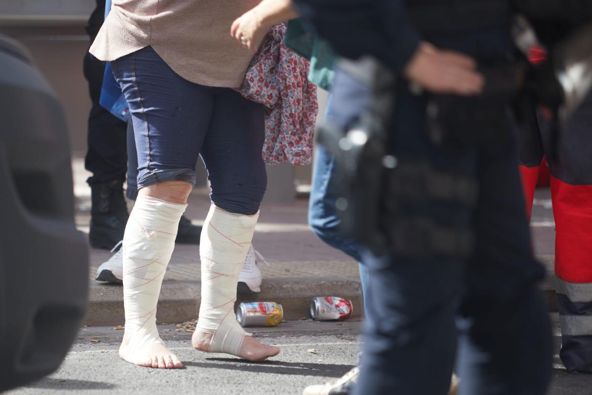 Una mujer fue vendada en ambas piernas tras ser atendida por quemaduras.