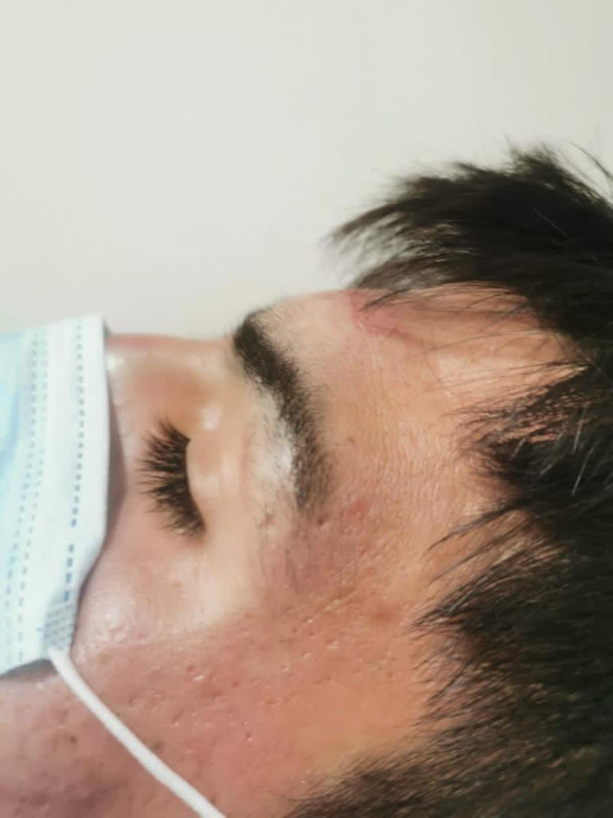 Kevin muestra sus heridas tras la trifulca Kevin muestra sus heridas tras la trifulca