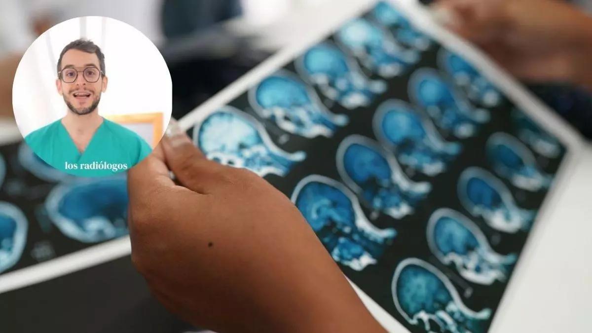 El doctor y divulgador, José Manuel Felices, explica el protocolo ictus en los centros sanitarios.