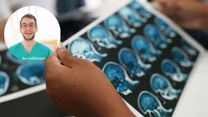 El doctor y divulgador, José Manuel Felices, explica el protocolo ictus en los centros sanitarios.