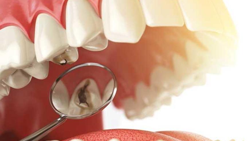 ¿Se contagian las caries?