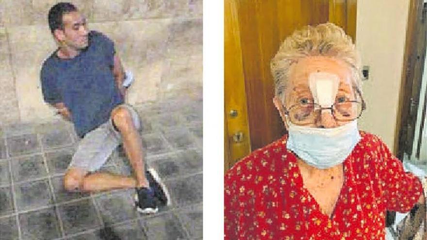 La anciana que fue brutalmente agredida: «Me golpeó con la puerta de hierro y quedé sangrando»