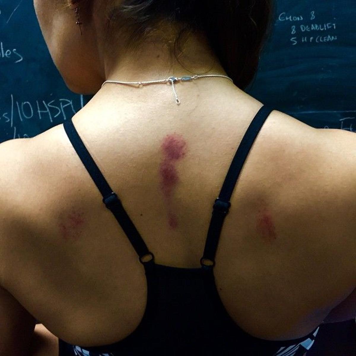 Heridas de guerra, Cristina Pedroche Instagram