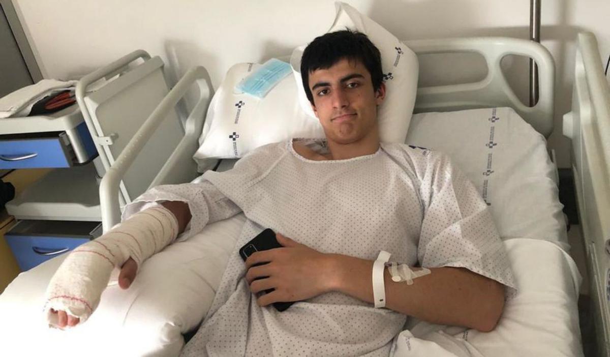 jorge arias, canterano del Ocb, operado de una mano. El junior masculino Jorge Arias se sometió ayer a una operación en un dedo de la mano derecha tras lesionarse entrenando. El base, en la imagen tras la intervención, se perderá el campeonato de España juvenil y la fase de ascenso a EBA del filial. | OCB