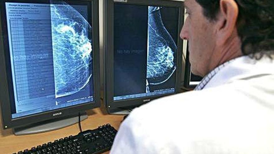 Un facultativo de la Unidad de Mama del Hospital de A Coruña revisa una mamografía.