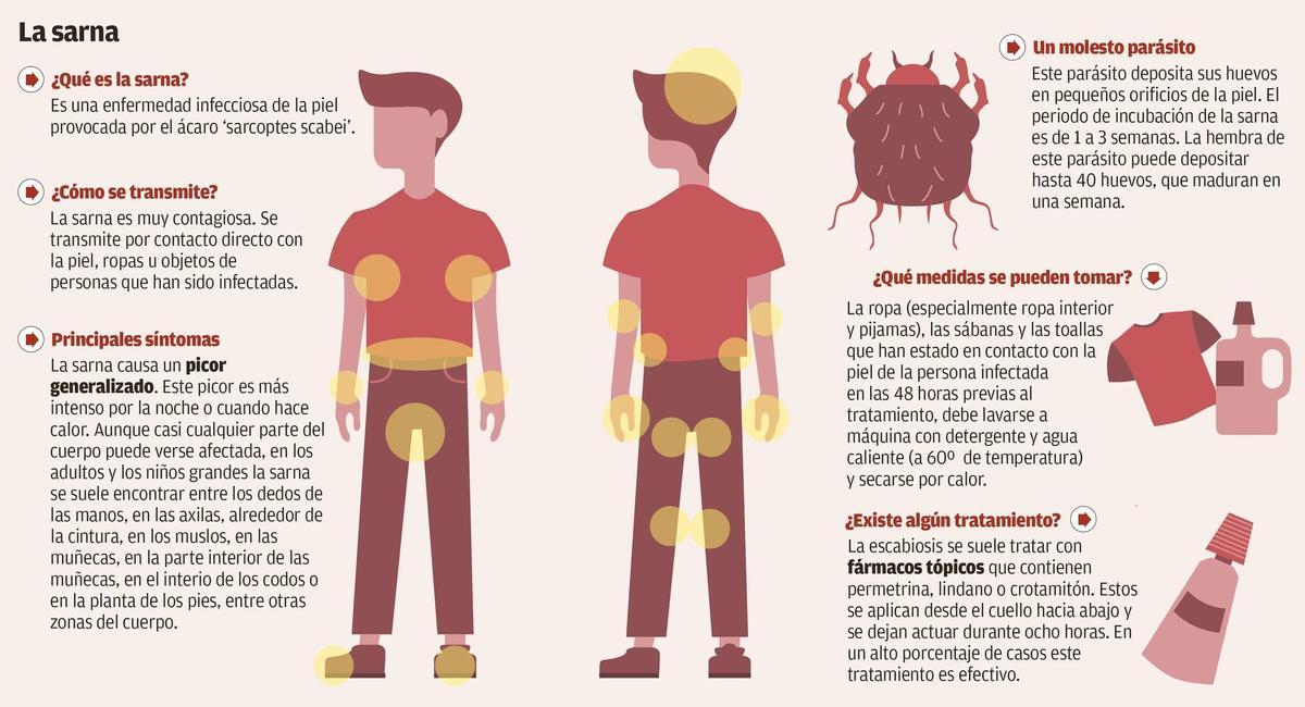 Sarna: Síntomas, tratamiento y complicaciones - Policlínica Metropolitana