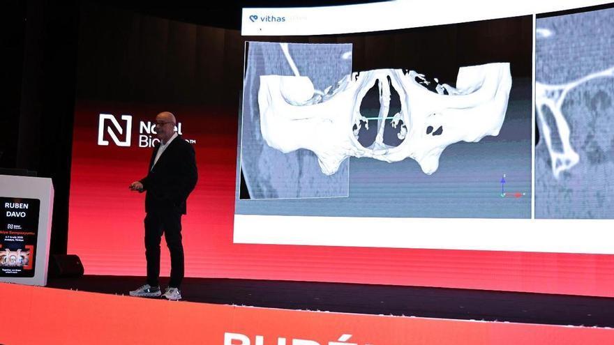Alicante, epicentro de la odontología mundial con el 20º aniversario de la técnica Zygoma Quad