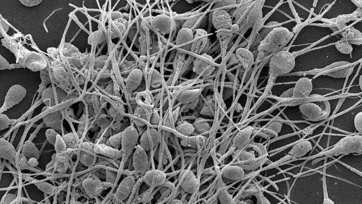 Un estudio demuestra que un fragmento testicular conservado desde la infancia puede seguir siendo viable y recuperar actividad reproductiva en la edad adulta.