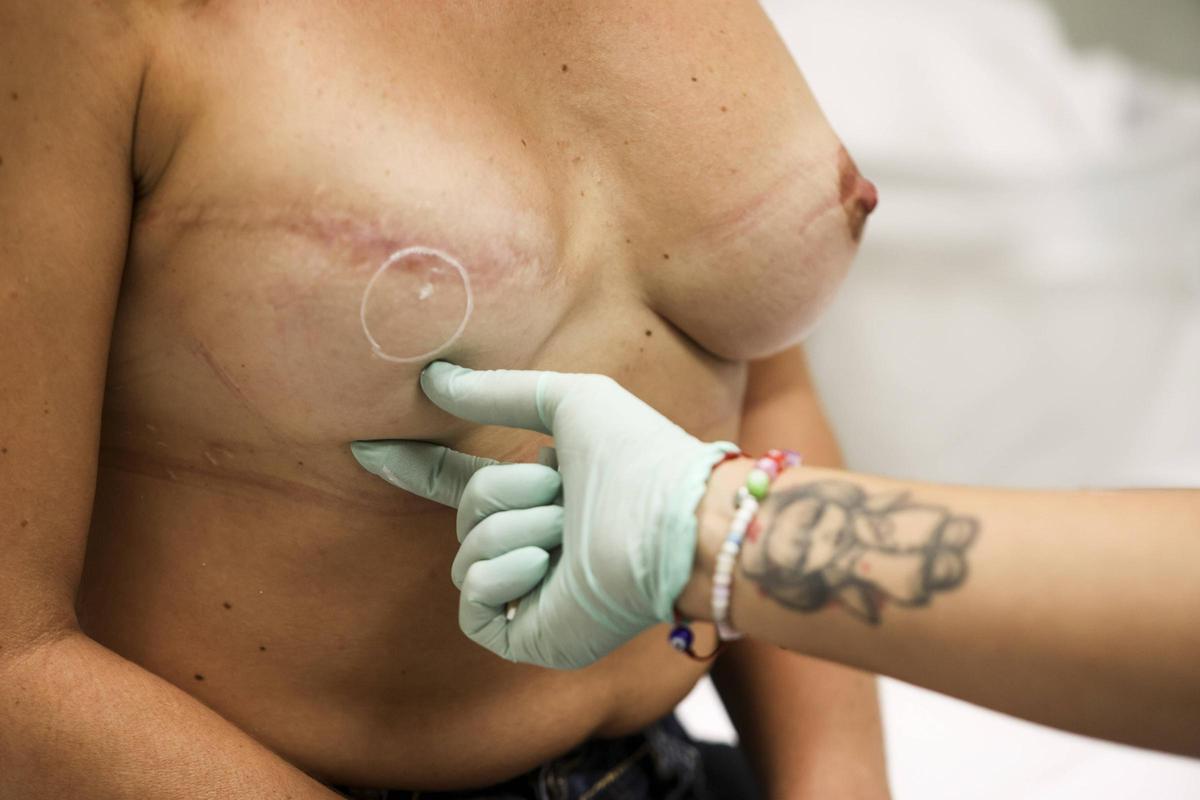 El primer paso es medir y diseñar dónde irá la areola y el pezón.