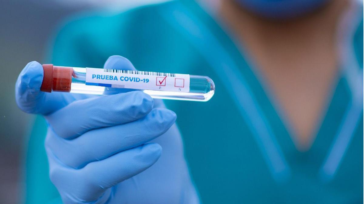 Las pruebas para detectar el coronavirus han supuesto una nueva línea de negocio para laboratorios y clínicas privadas malagueñas.